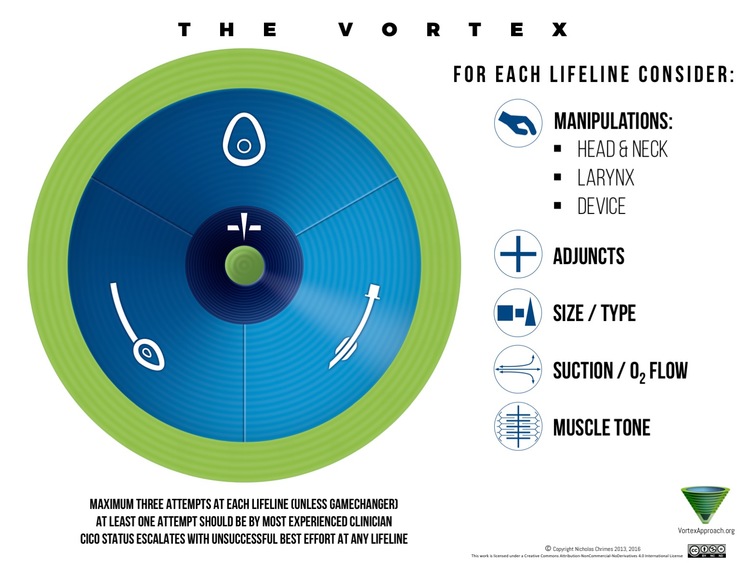 VortexApproach